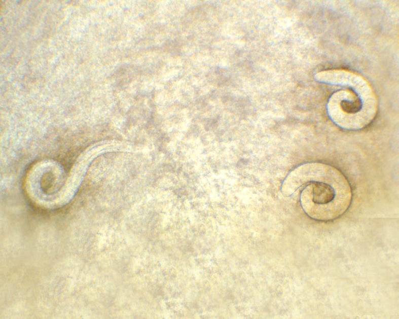 Protostrongylidae larvae from mollusks of Armenia (a)